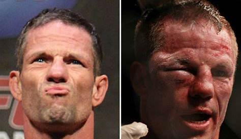 UFC Fighters Before And After A Fight (15 pics)