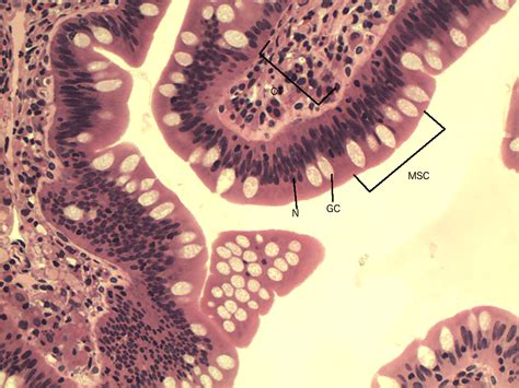 Modification Of Columnar Epithelium