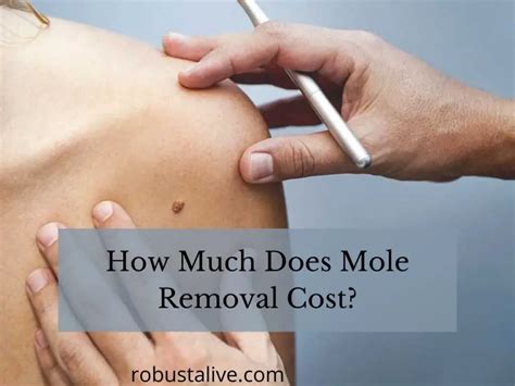mole removal cost with insurance
