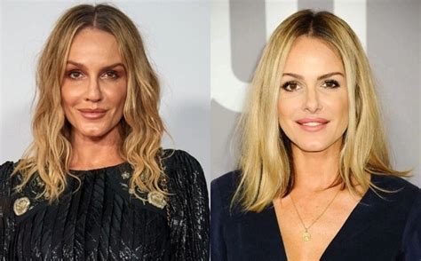 monet mazur plastic surgery