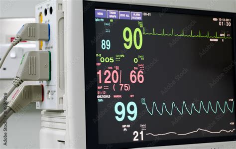 Monitor Hospital Reading