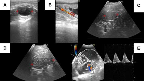 Monitoring Mare Pregnancy
