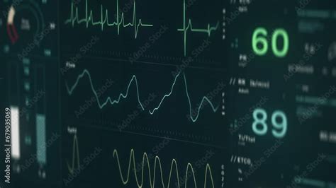 Monitoring Respiratory Rate