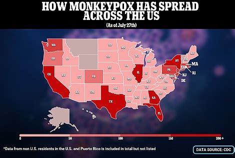 Monkeypox Cases By State In Us