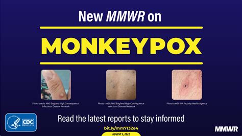 monkeypox cdc guidance