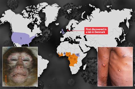 monkeypox outbreak 2021 uk