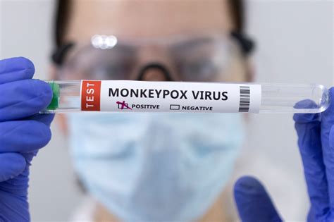 Breaking Down the Monkeypox Virus Vaccine: What You Need to Know About Protection and Prevention