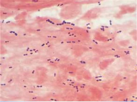 morphology of streptococcus pneumoniae