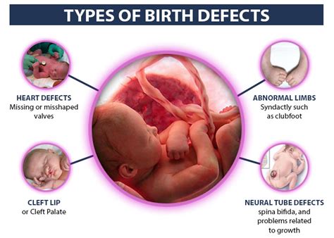 Most Dangerous Birth Defects