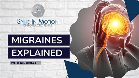 Motion Migraines