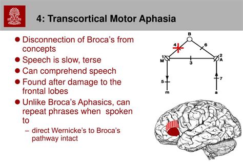Motor Aphasia Example