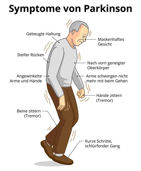 motorische symptome bei parkinson