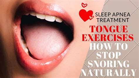 mouth exercises for sleep apnea