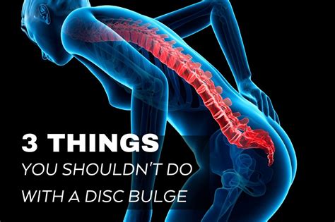 movements to avoid with bulging disc