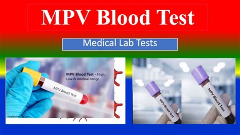 mpv blood test 8.4