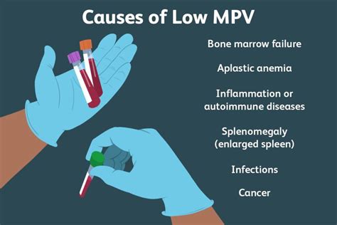 Mpv Elevation Causes