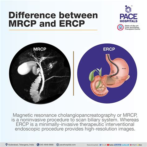 MRCP vs ERCP: Which Diagnostic Procedure is Right for You?