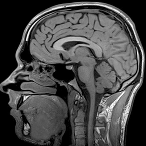 Understanding the Importance of MRI of Head Diagnostics Today
