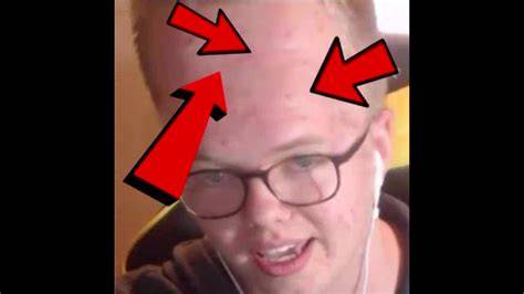 MrTlexify Forehead YouTube