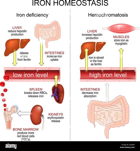Ms And Iron Levels