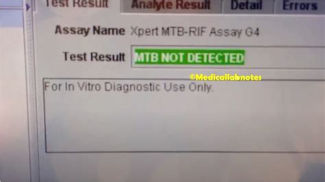 mtb not detected