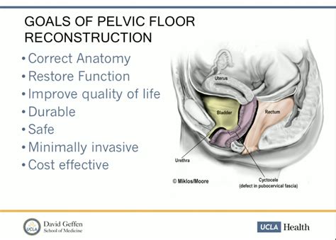 muceus leakage one month after pelvic floor surgery