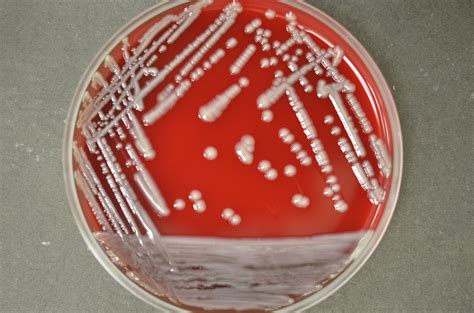 mucoid colonies on blood agar