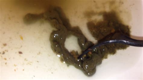 mucoid plaque rope worm