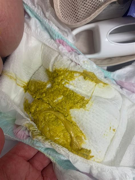 mucus in 4 month old baby stool