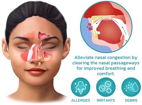 Understanding the Mucus Plug Nasal: What You Need to Know About This Common Phenomenon
