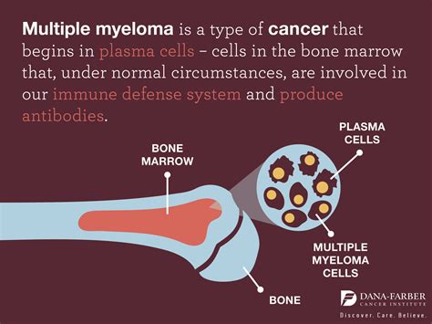 multiple myeloma bone marrow cancer