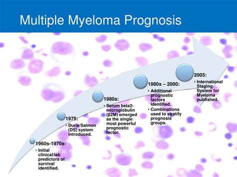 multiple myeloma prognosis 2020