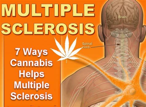multiple sclerosis medical marijuana