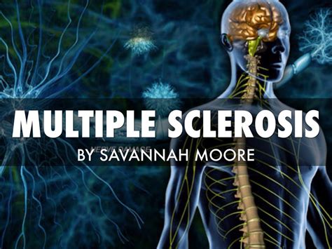 multiple sclerosis powerpoint template