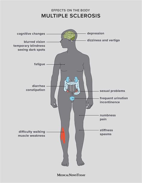 multiple sclerosis symptoms in females