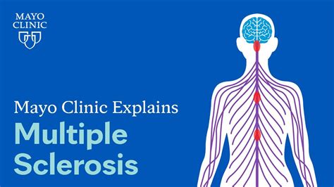 multiple sclerosis symptoms mayo clinic