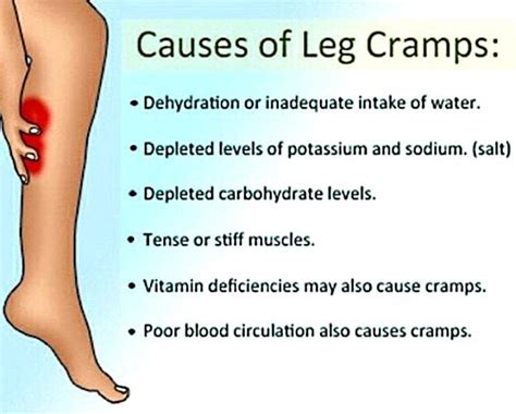 Treat Muscle Cramps with Vitamins and Minerals Top 10 Home Remedies