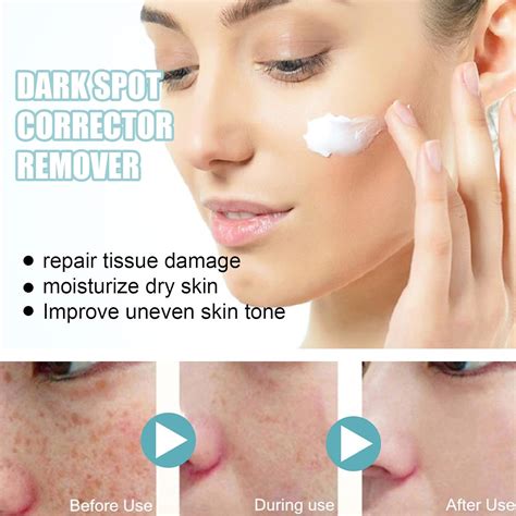 Musely For Dark Spots