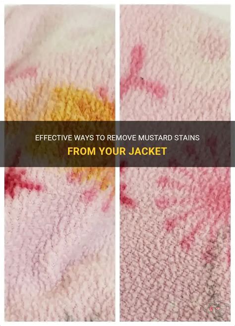 Mustard Stains On Jacket