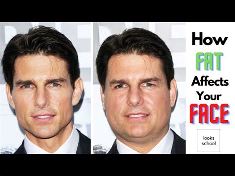 My Face Keeps Getting Fatter