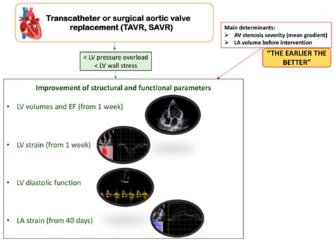 Advances in Myocardial Valve Replacement: What You Need Know