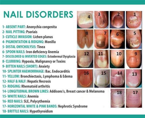 Medical infographic What Your Fingernails Say About Your Health