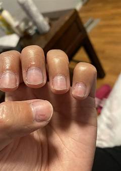 Nails After Dip Powder Removal