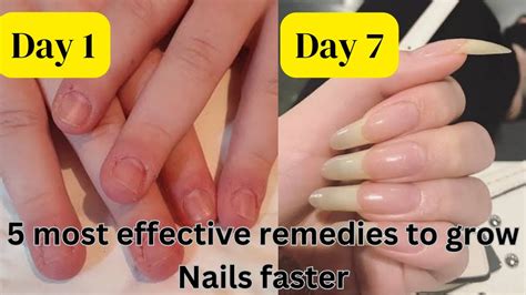 Nails Growing Really Fast