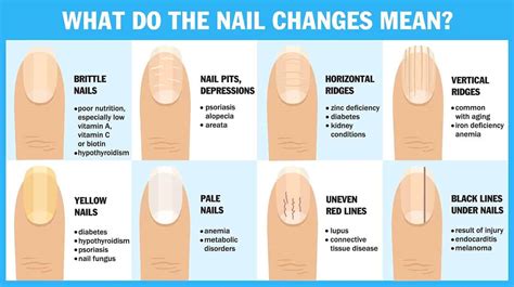 Nails Health Chart