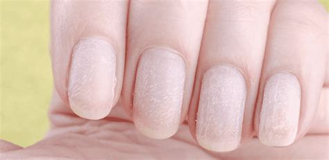 Nails Hurt When Cold