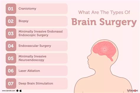 name of brain surgeon