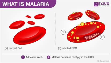 name the vector and causative agent of malaria