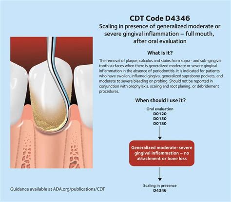 Narrative For Dental Code D4346