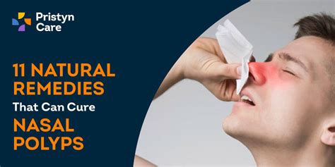 nasal polyps remedy
